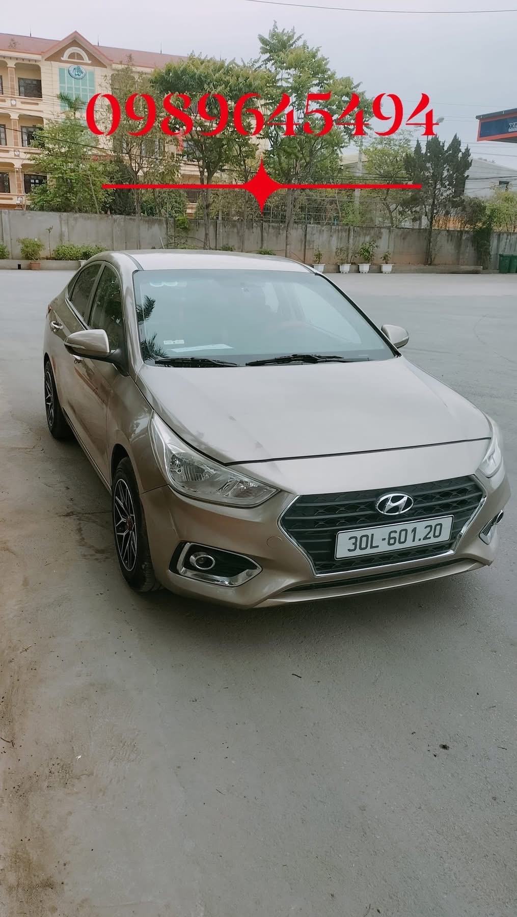 Hyundai Accent 1.4 MT Base 2018 - Ngoại thất 3